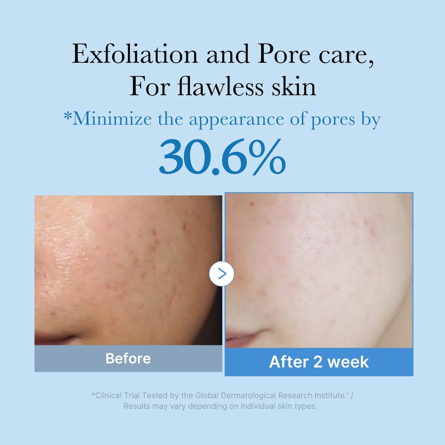 zero-pore-toner-l0 01_d6480b4e-3c08-4954-994a-ed5212c1839c.jpg
