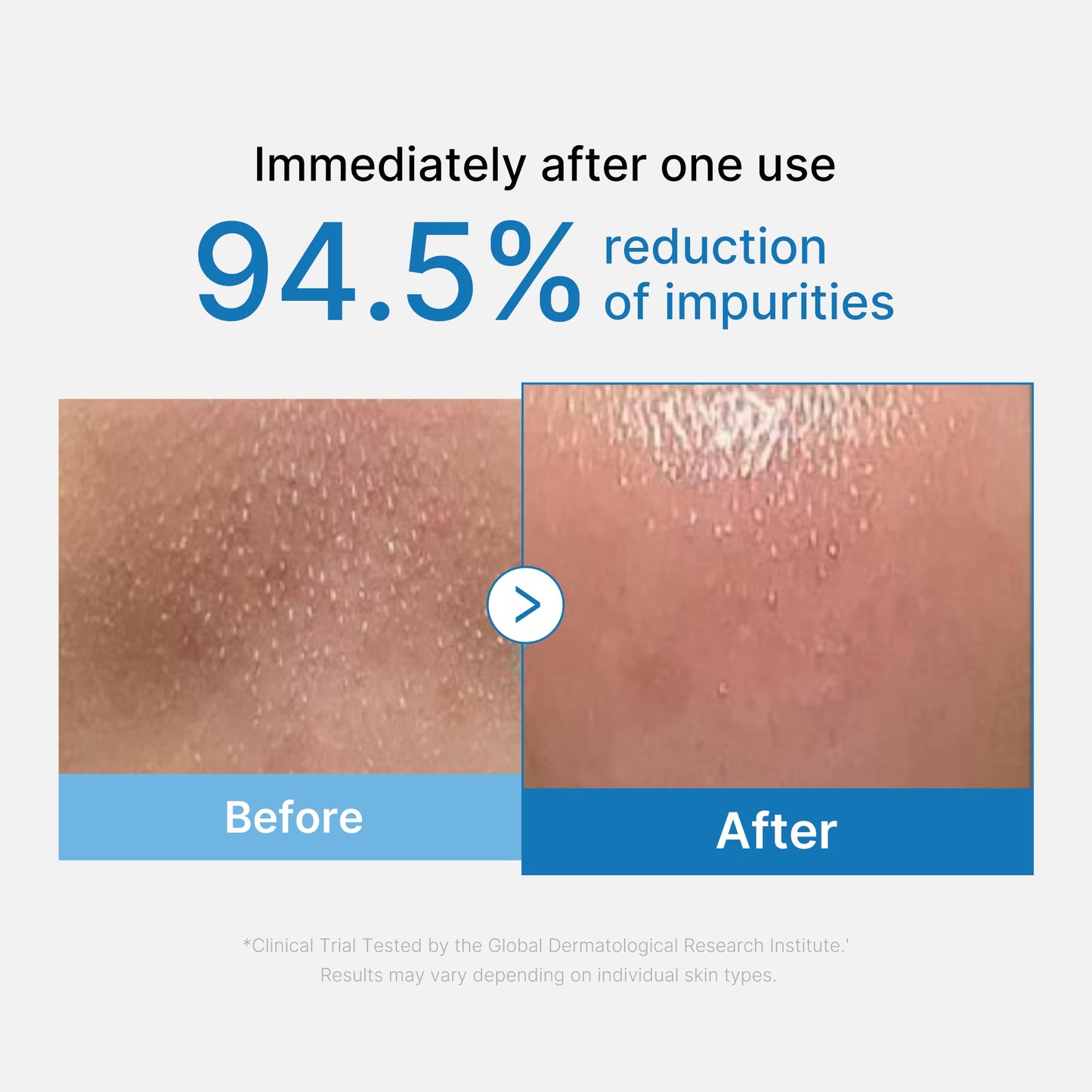 zero-pore-blackhead-deep-cleansing-oil-m2 01_eed557ec-5857-46a2-8b17-dbd67c692dcb.jpg