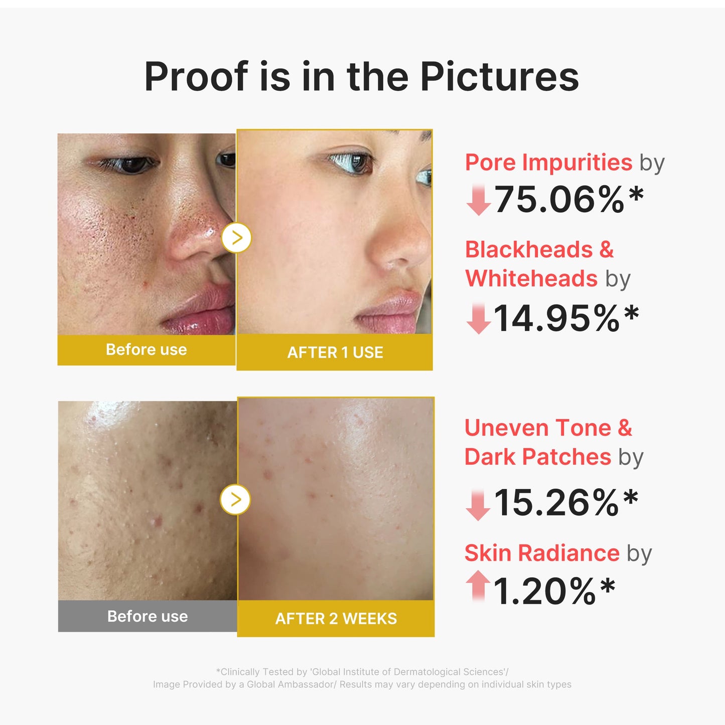 kojic-acid-turmeric-peel-shot-z7 02_45fe66d3-b3f6-4100-aa52-2afd7eded417.jpg
