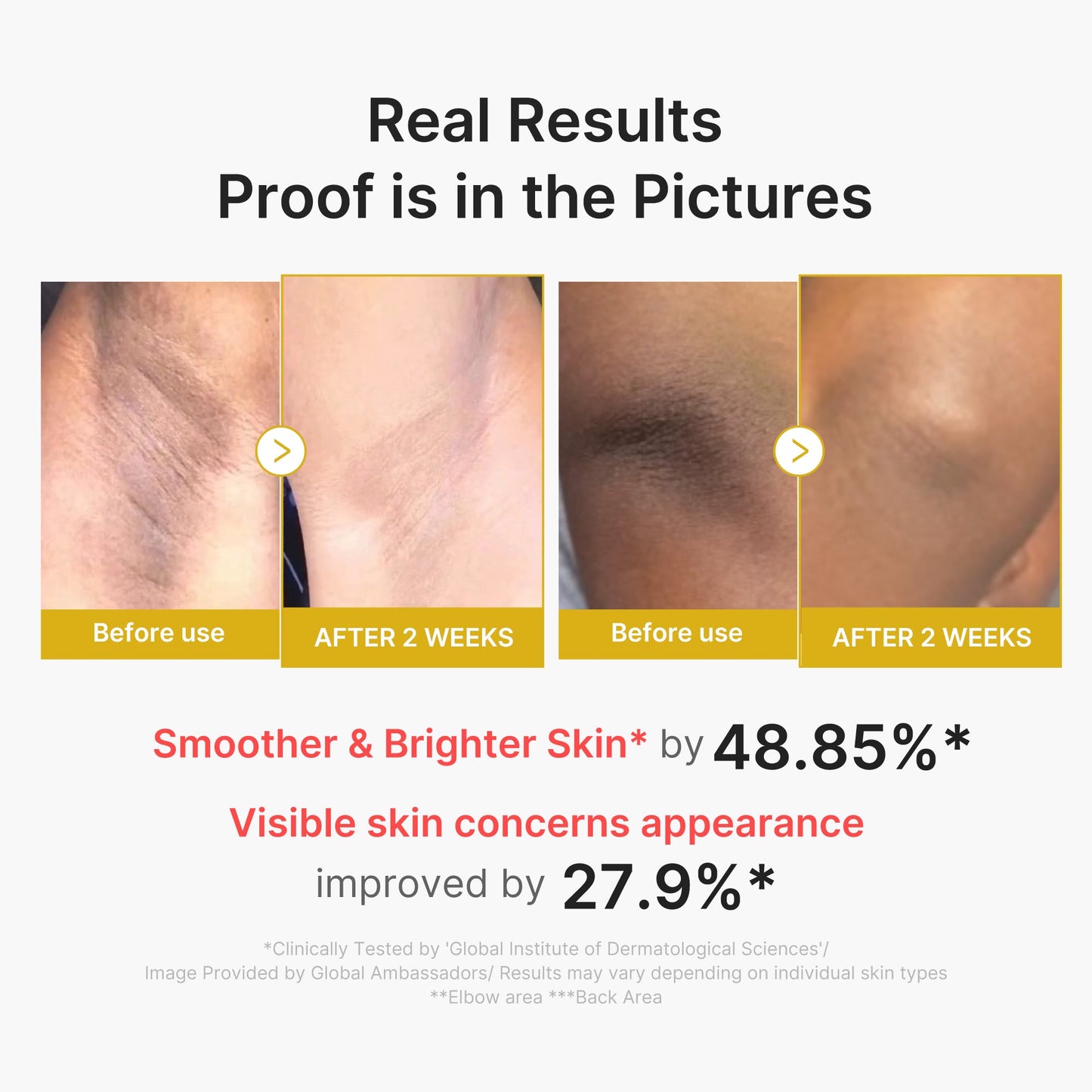 kojic-acid-turmeric-body-peel-shot-v3 02_72880cfc-382b-440b-8152-7e3dce87da2a.jpg
