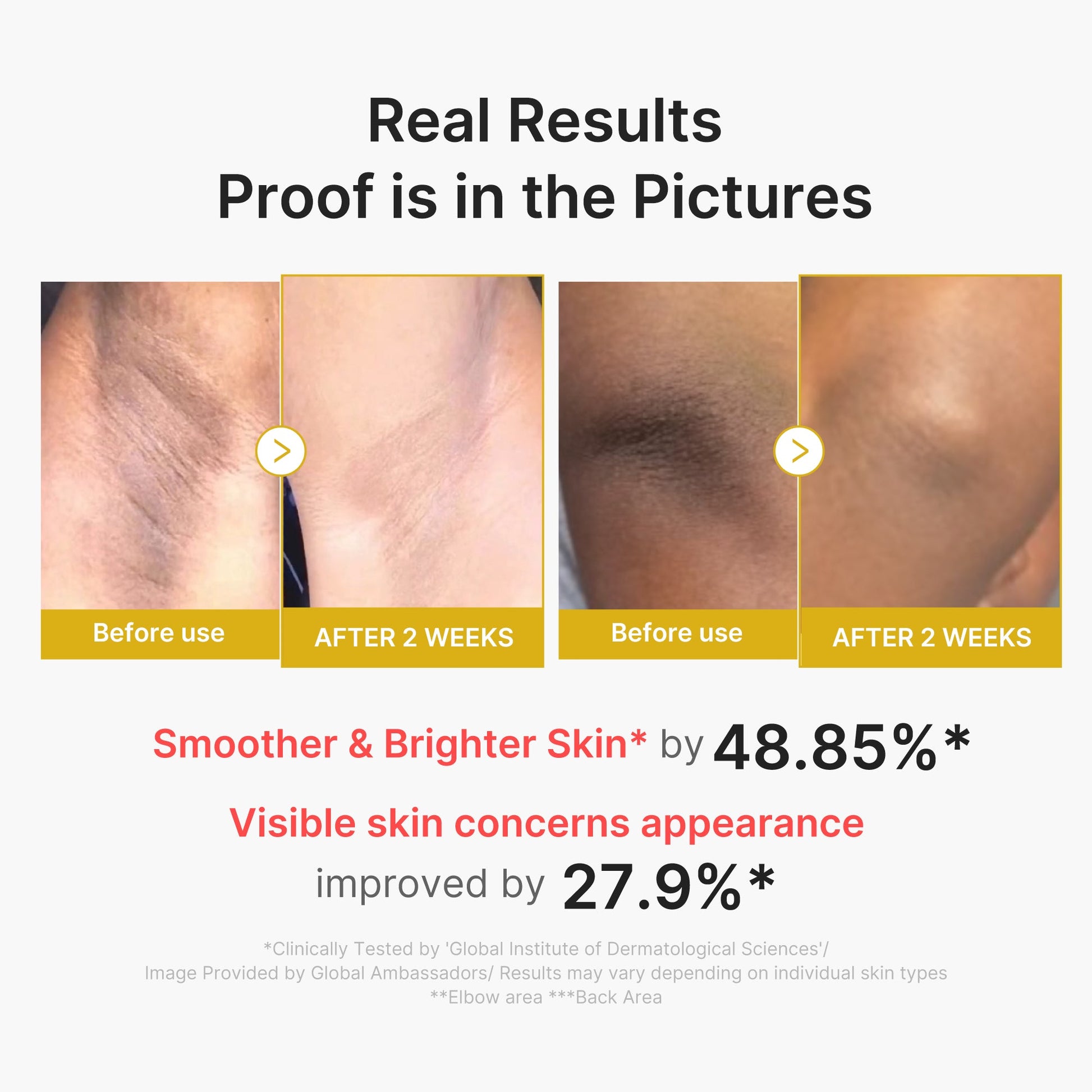 kojic-acid-turmeric-body-peel-shot-v3 02_72880cfc-382b-440b-8152-7e3dce87da2a.jpg