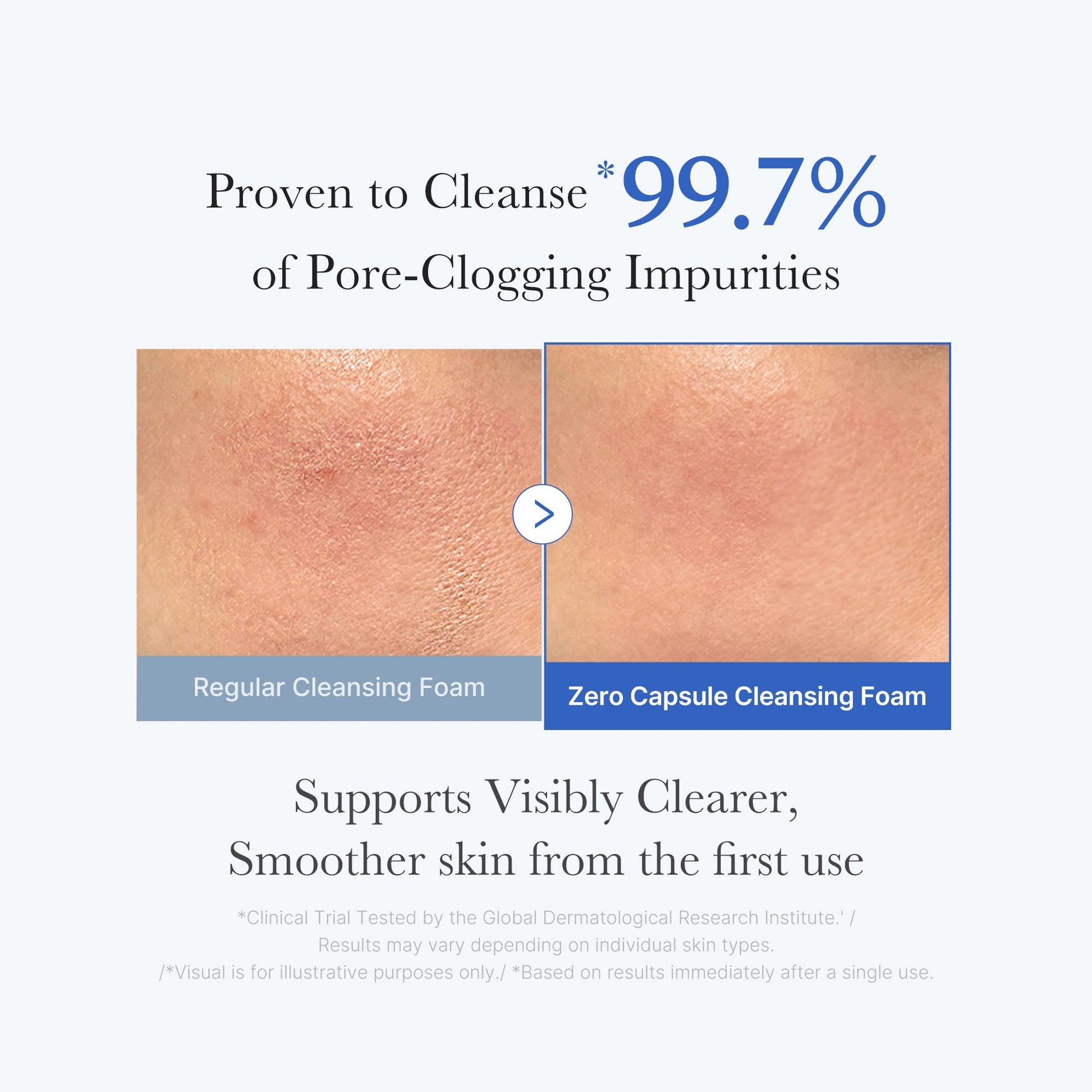 zero-pore-capsule-cleansing-foam-u8 02_c1fb9dfb-86c5-4038-8ff8-490d1006276c.jpg