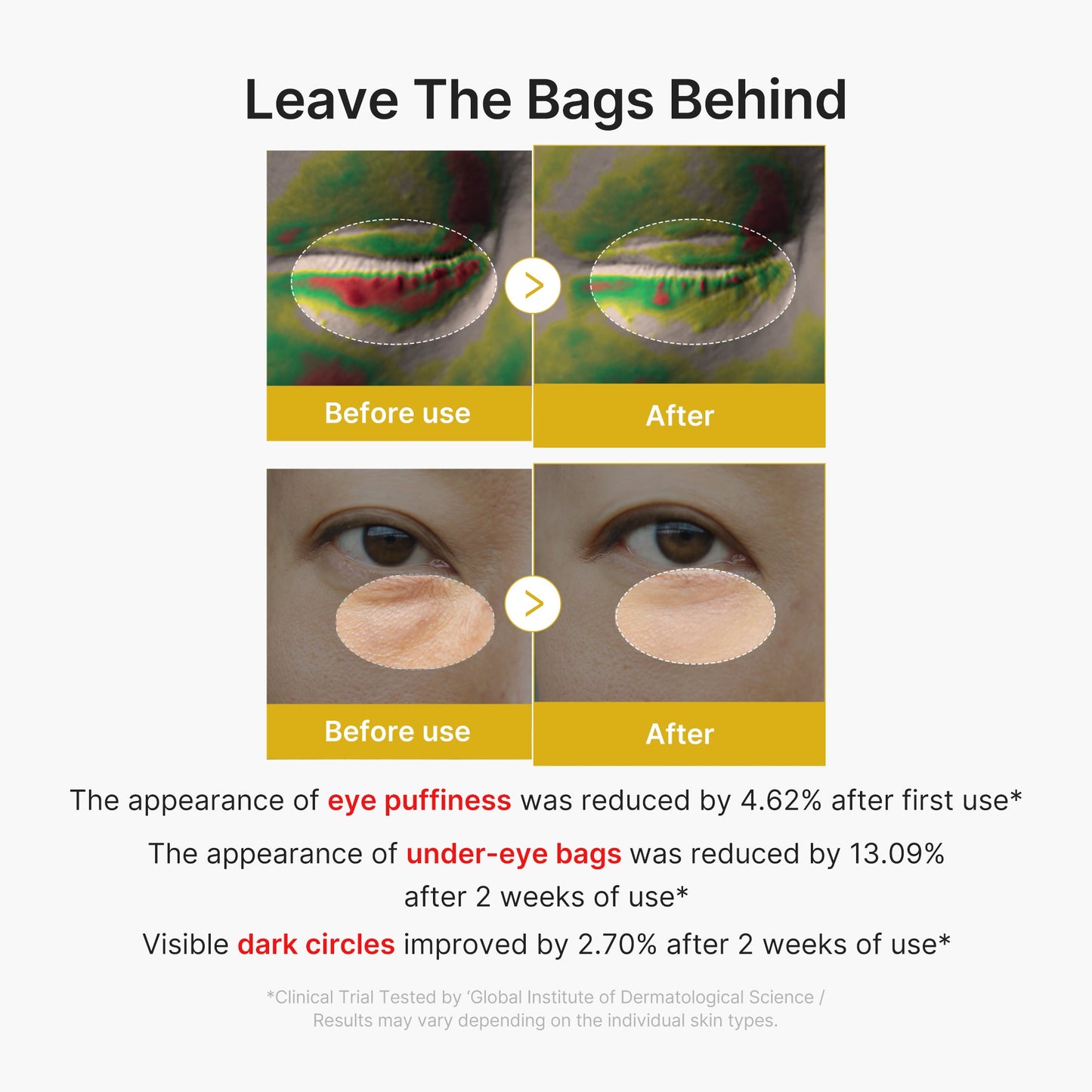 kojic-acid-tumeric-eye-gel-serum-r1 03-2.jpg