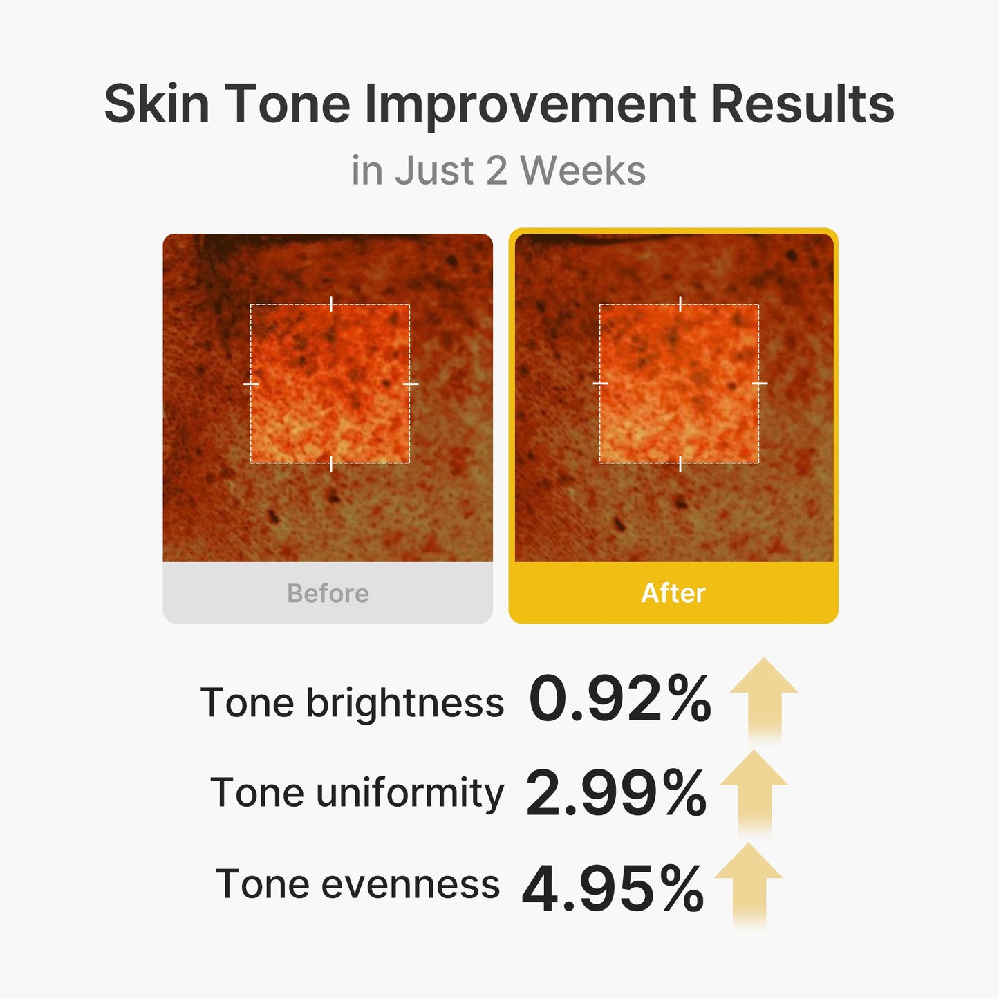 kojic-acid-turmeric-vita-capsule-cream-i9 03_2b626701-fc6c-4702-9e96-a2157a4f7f9d.jpg