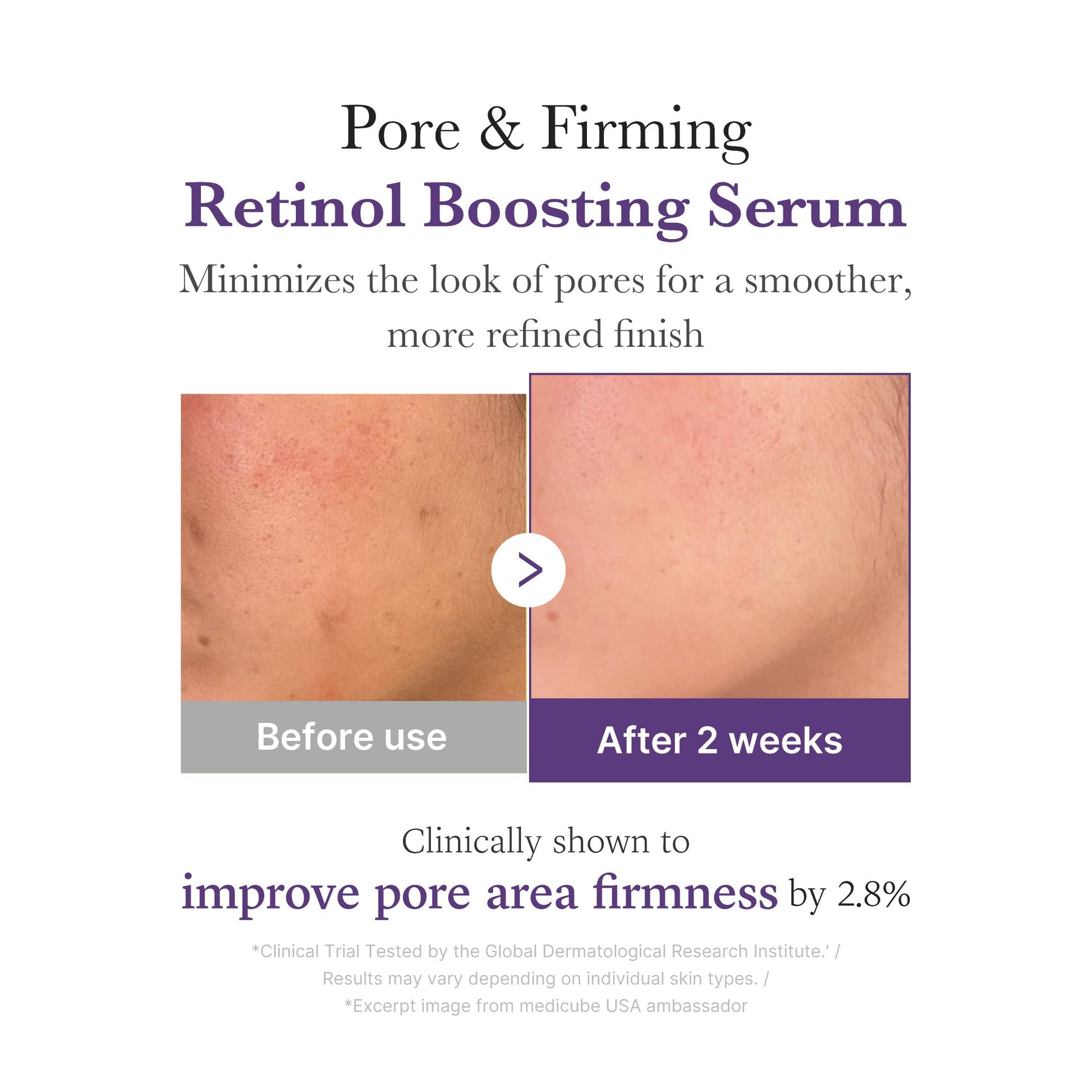 retinol-nmn-boosting-serum-i2 03_3510e7a5-5633-4a18-81ea-1389593bd517.jpg