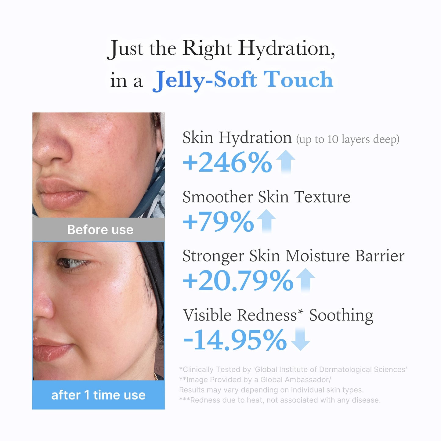 hyaluronic-ceramide-moisturizing-jelly-cream-i0 03_c39d66cc-0839-4e48-ab4a-d32143d06b1c.jpg