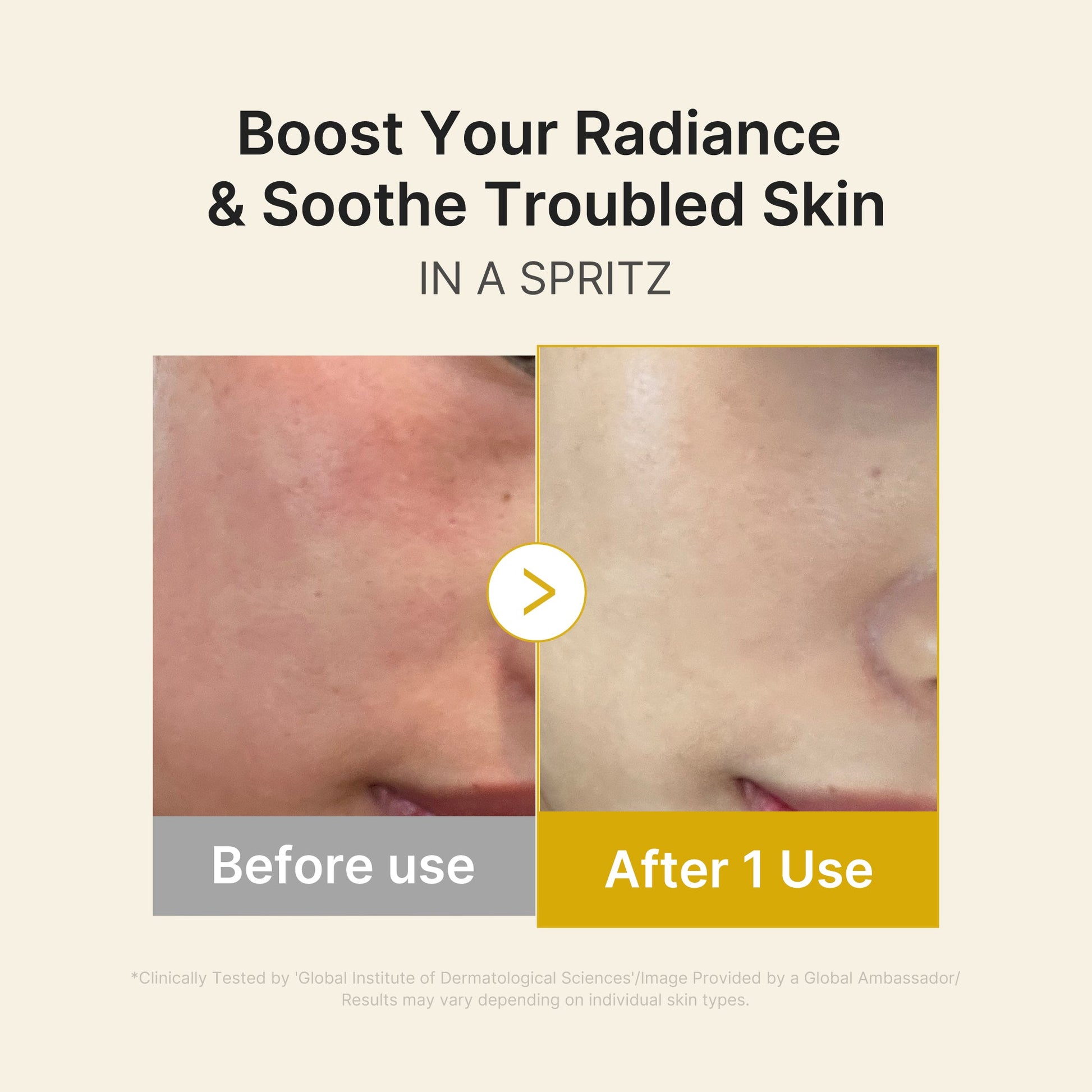 kojic-acid-turmeric-vitamin-gold-jelly-mist-serum-l9 03_dc9cd19e-4e57-49d3-9b66-c7762e8a63f1.jpg