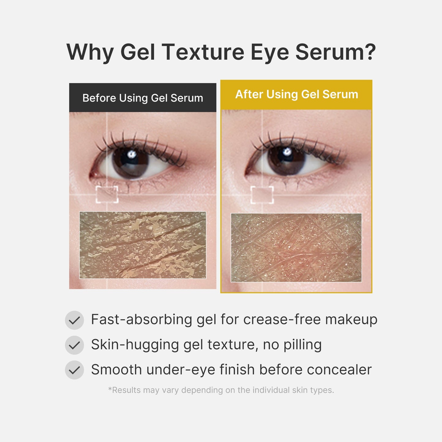 kojic-acid-tumeric-eye-gel-serum-r1 04_0487ef36-49f4-4294-8049-bb55118b05fe.jpg