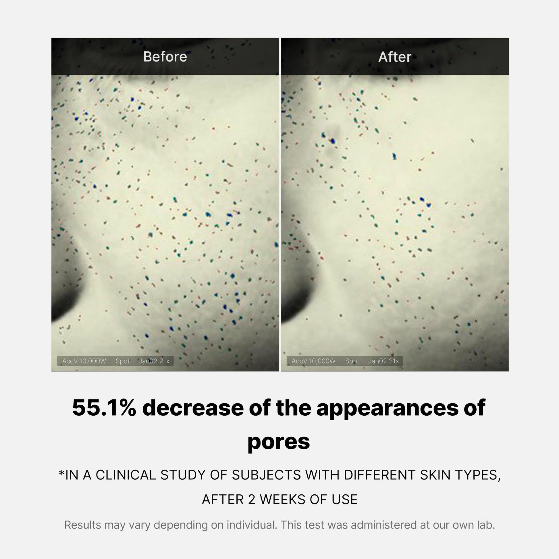 zero-pore-one-day-cream-y2 04_3616addc-f184-4deb-a5d7-e3a782e4713d.jpg