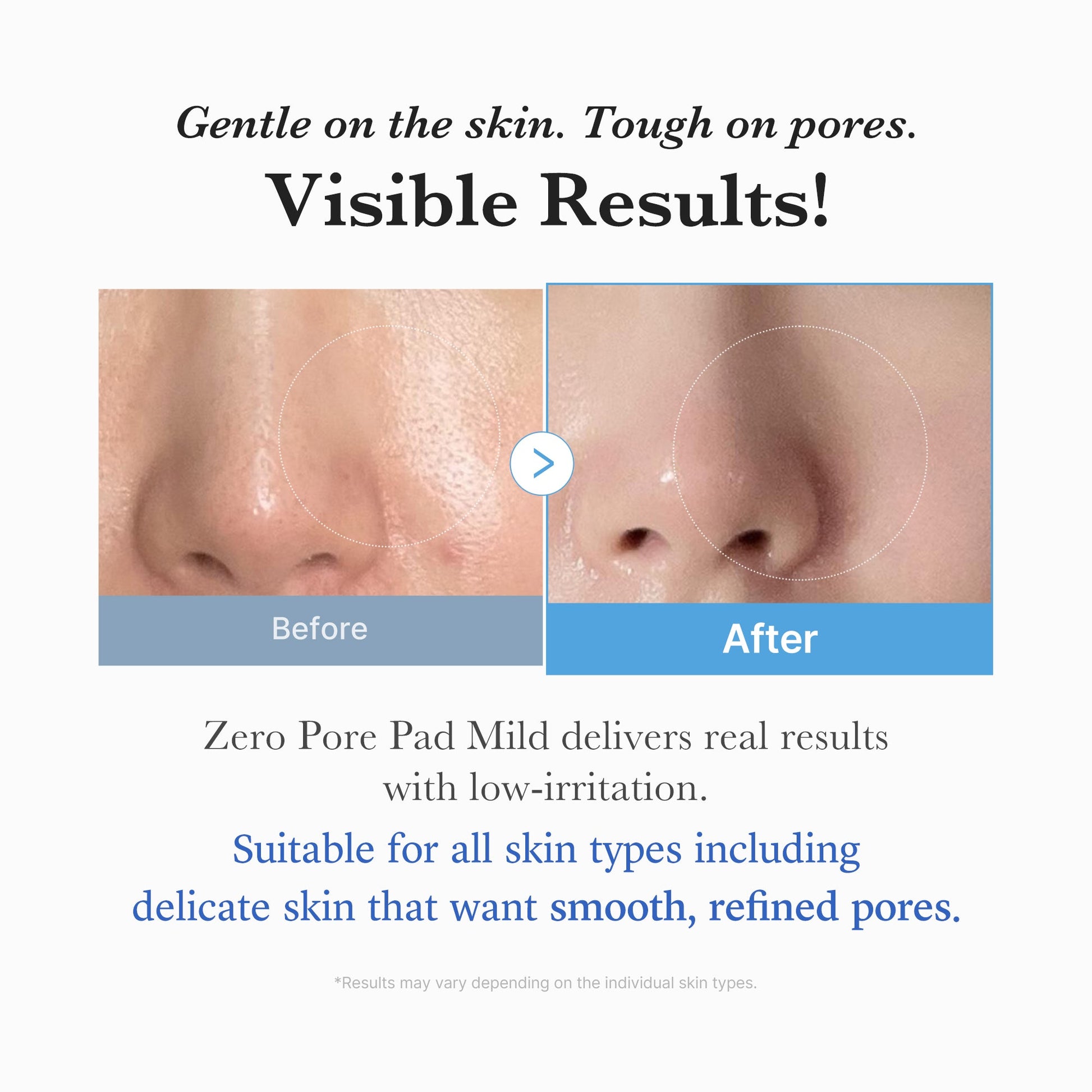 zero-pore-madecassoside-pads-mild-m9 04_6357f9f9-483b-4891-82c6-a58d336e62c8.jpg
