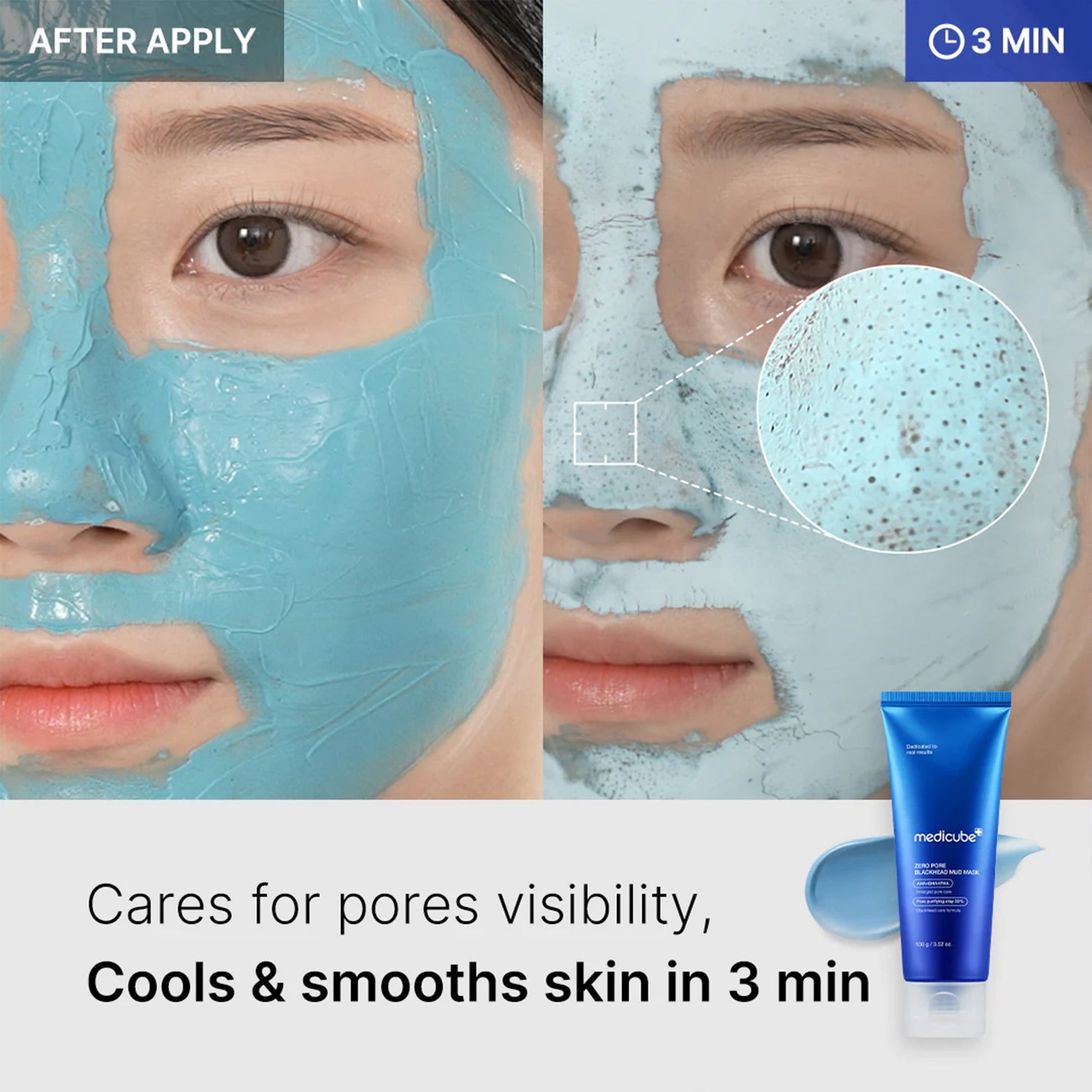 zero-pore-blackhead-mud-mask-j9 04_867c0459-a94e-40d3-bd9a-70400edabe8d.jpg