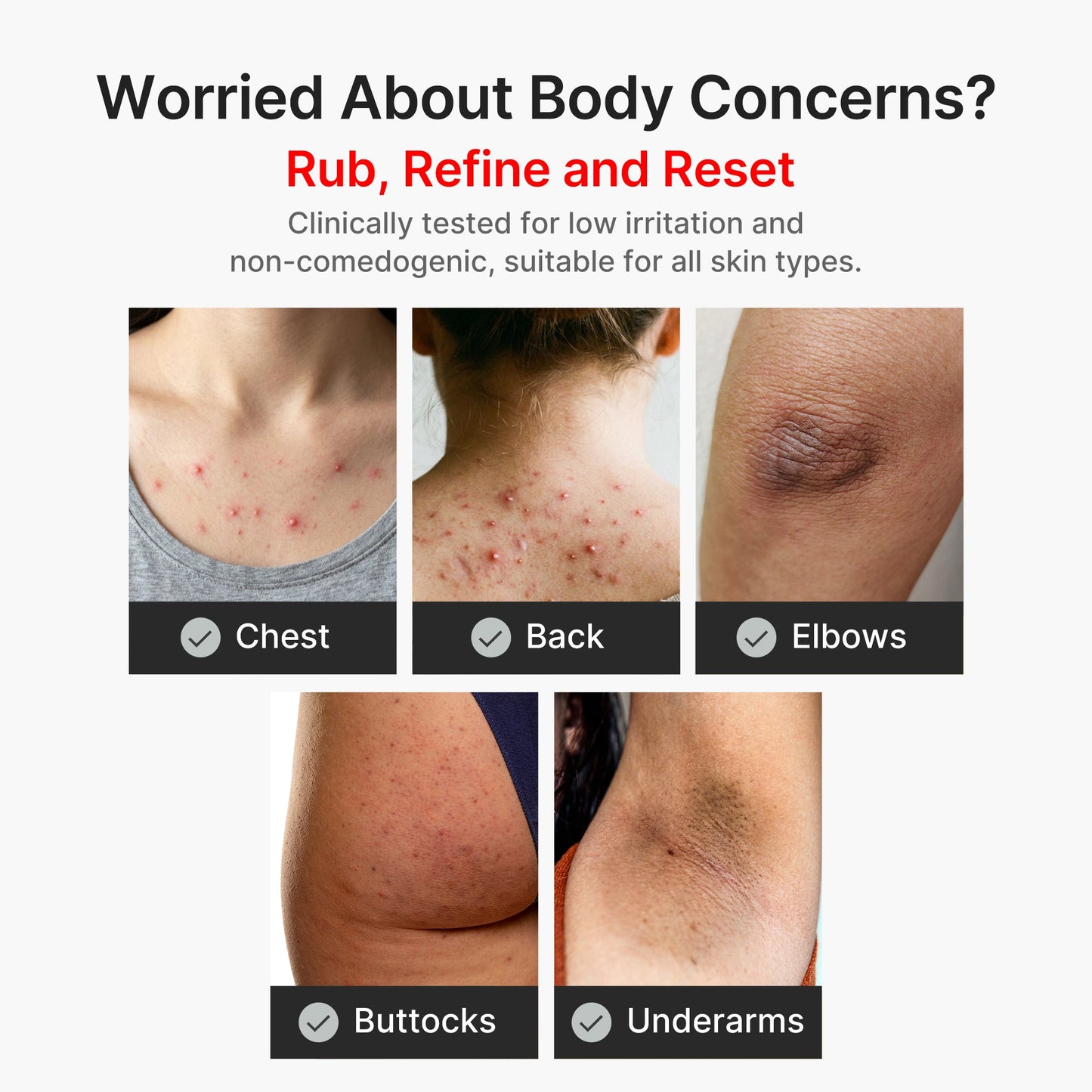 kojic-acid-turmeric-body-peel-shot-v3 04_8a7237f2-3ebf-401e-bd85-54841aeb3efc.jpg