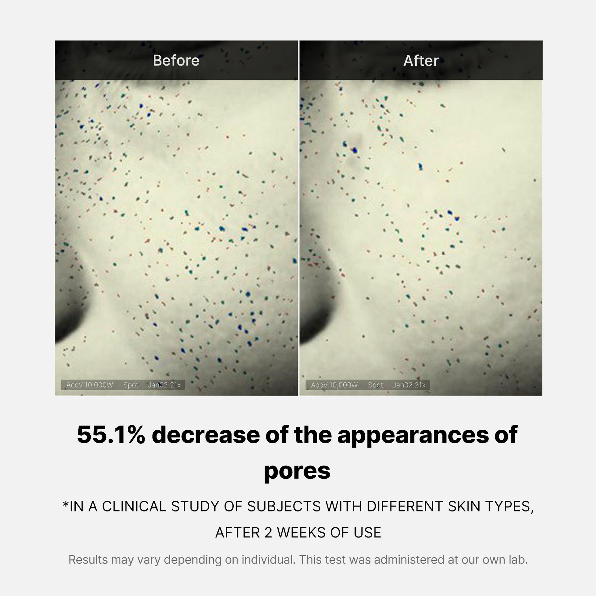 pore-care-duo-z7 05_12ddab8a-64be-4612-8ee1-27e5ec701921.jpg