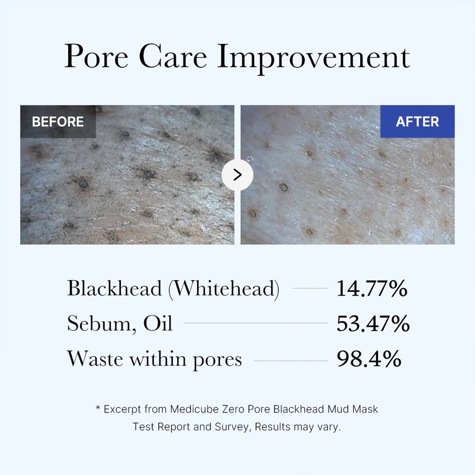 zero-pore-blackhead-mud-mask-j9 05_9362a158-c2b3-4525-acc0-631a2cfdea47.jpg