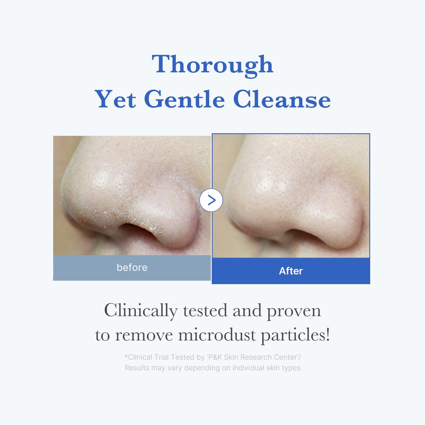 zero-foam-cleanser-l0 250702_ZeroCleanser3.jpg
