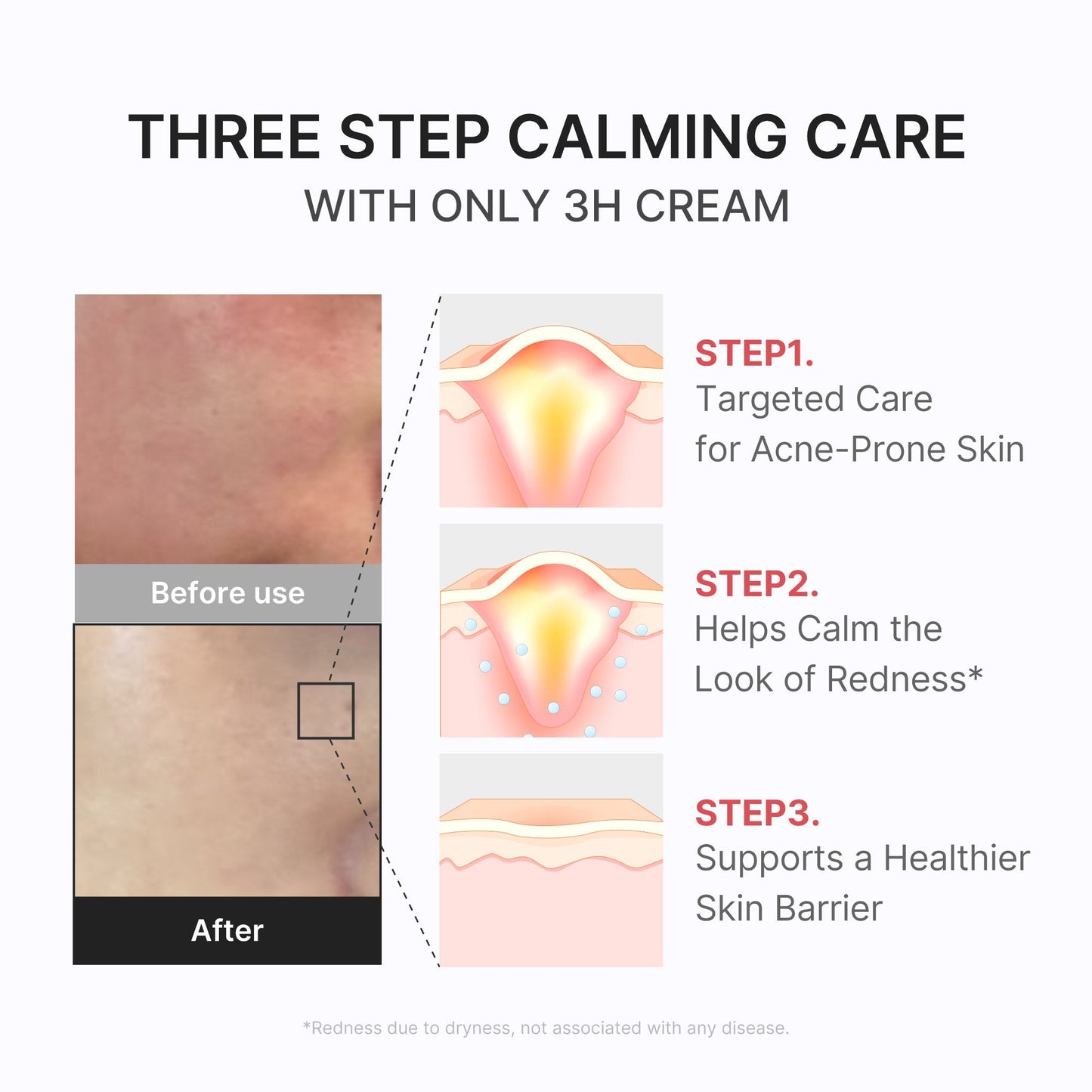 3h-daily-relief-cream-r6 3H_04.jpg