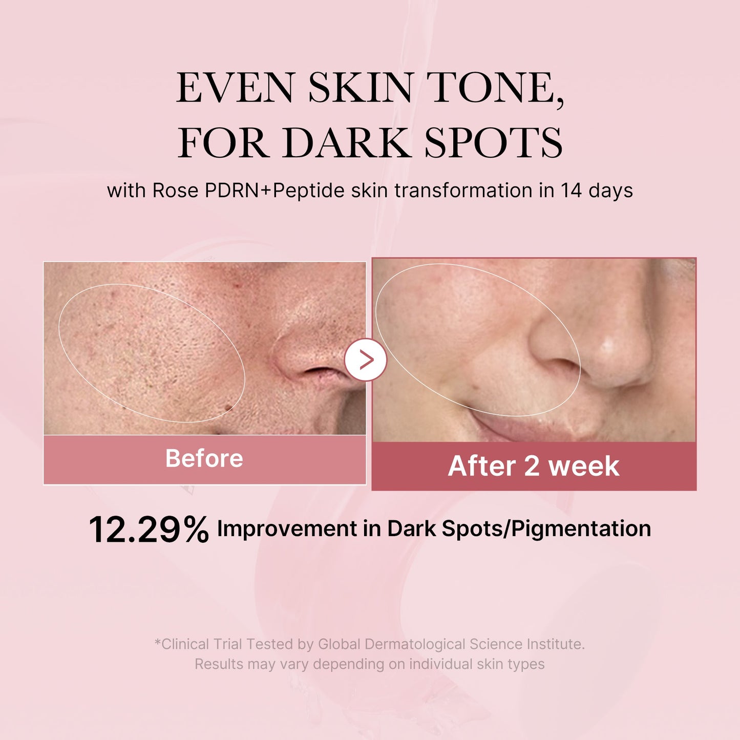 pdrn-pink-peptide-toner-h9 PDRN_01_308c518e-5ac6-4e54-99bd-eabc8796739b.jpg