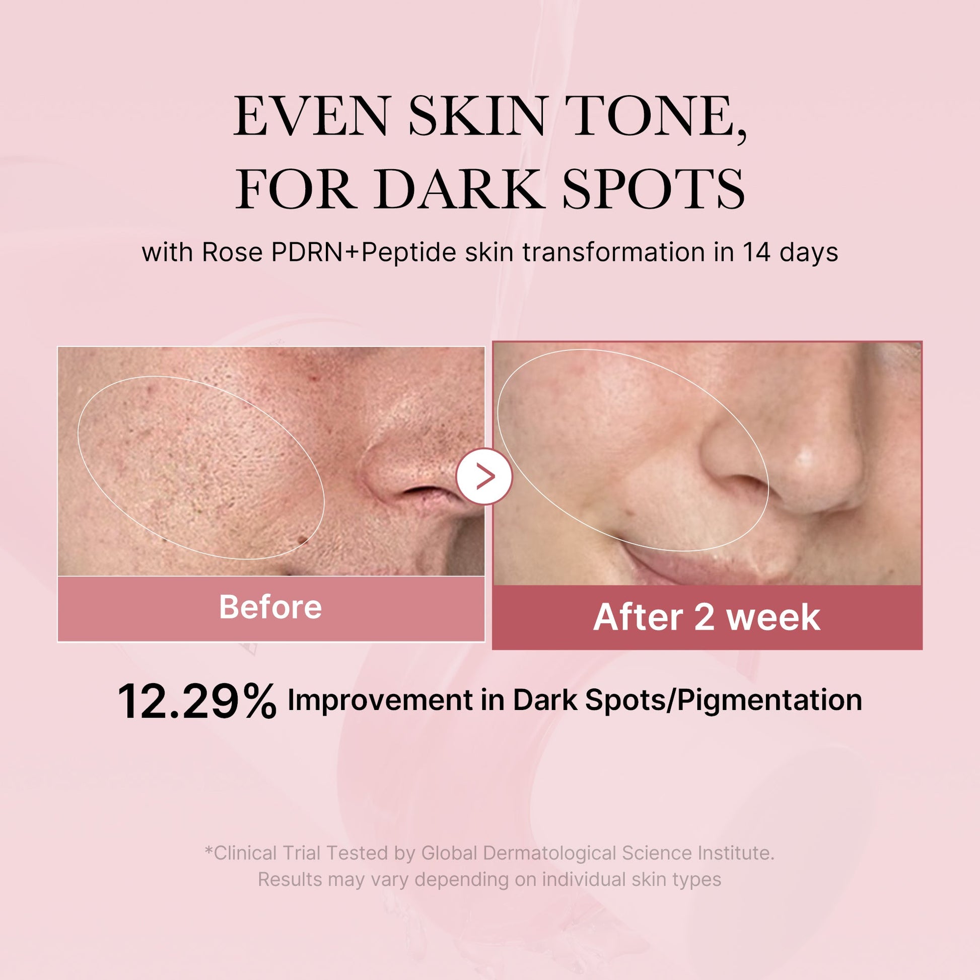 pdrn-pink-peptide-toner-h9 PDRN_01_308c518e-5ac6-4e54-99bd-eabc8796739b.jpg