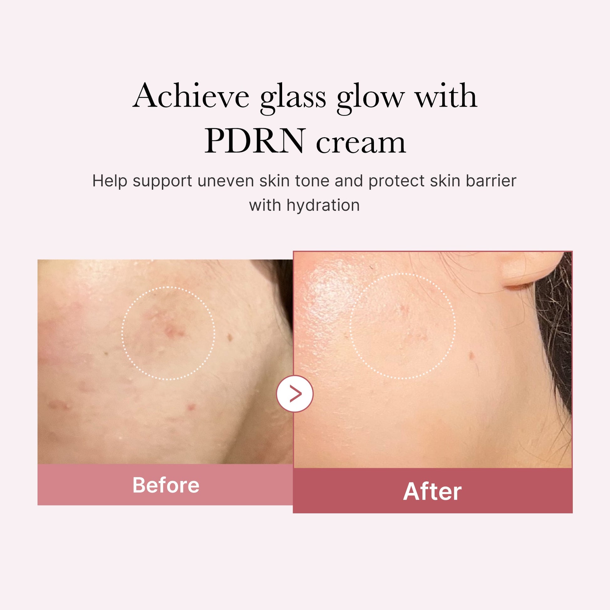 pdrn-pink-peptide-cream-i7 PDRN_02_d7805bfe-cf43-446a-b71b-a276683f136b.jpg
