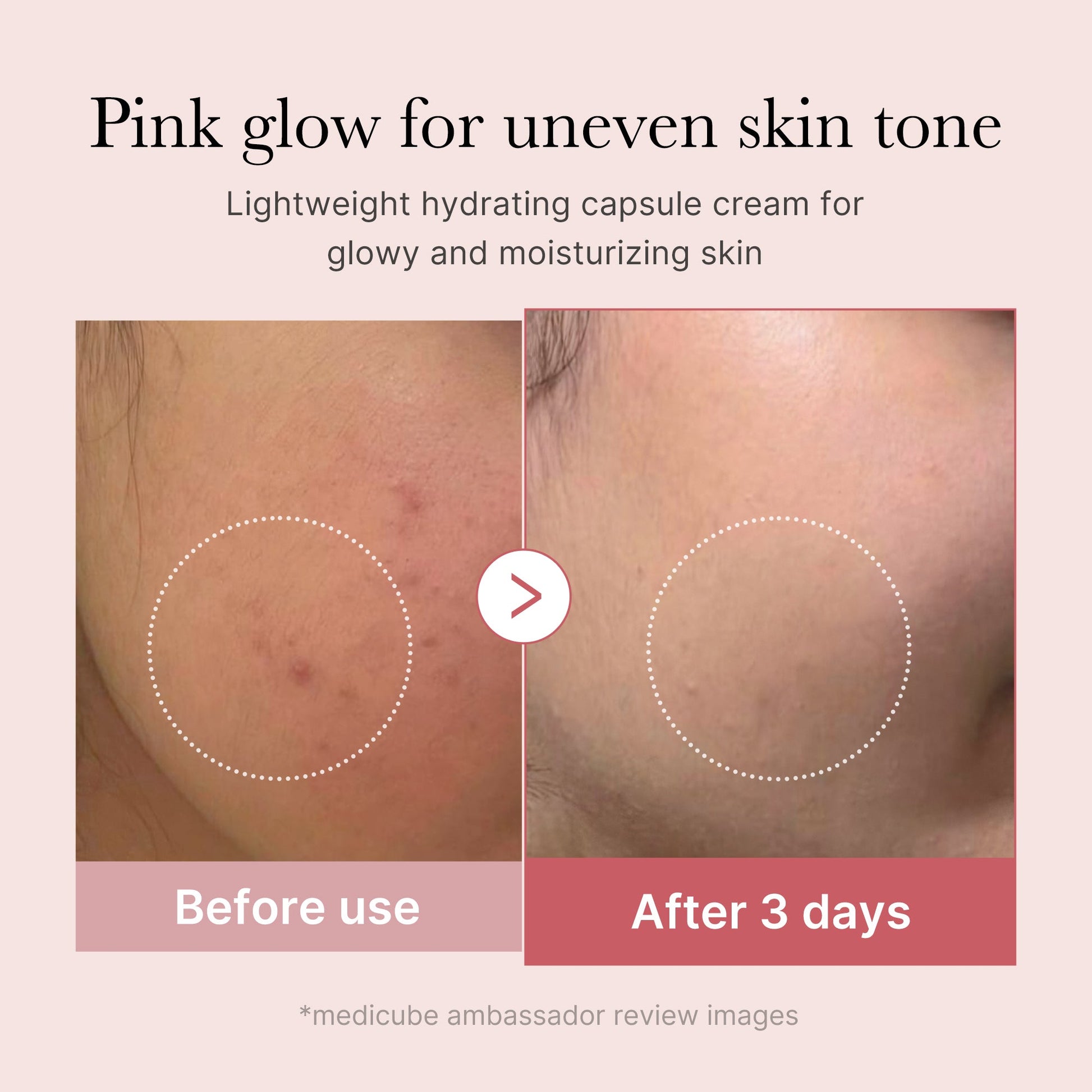 pdrn-pink-collagen-capsule-cream-x4 PDRN_03_058d09d8-4f44-4b1e-927c-e27b1738ae51.jpg