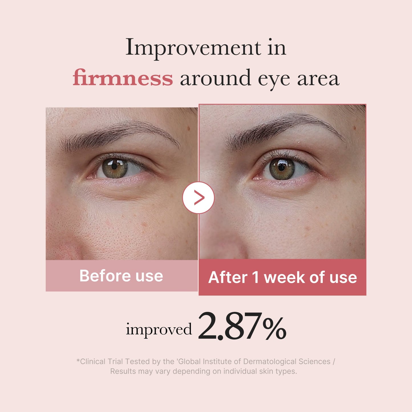 pdrn-pink-peptide-eye-cream-u7 PDRN_03_256dd753-0a2f-41b4-b3cd-bbfd3bc27018.jpg