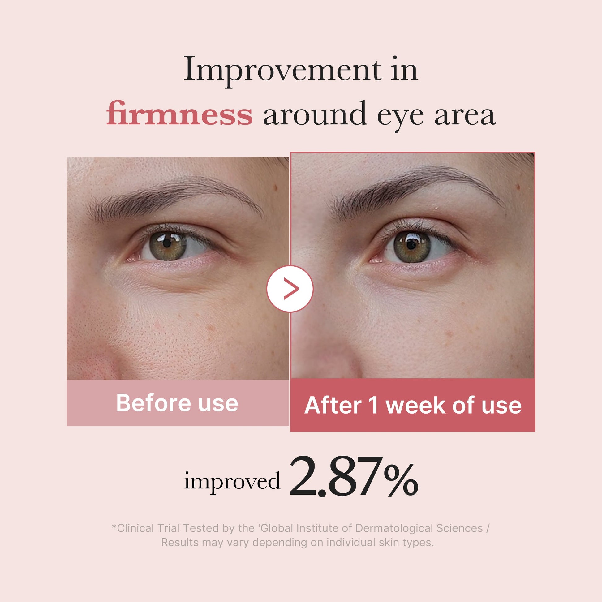 pdrn-pink-peptide-eye-cream-u7 PDRN_03_256dd753-0a2f-41b4-b3cd-bbfd3bc27018.jpg