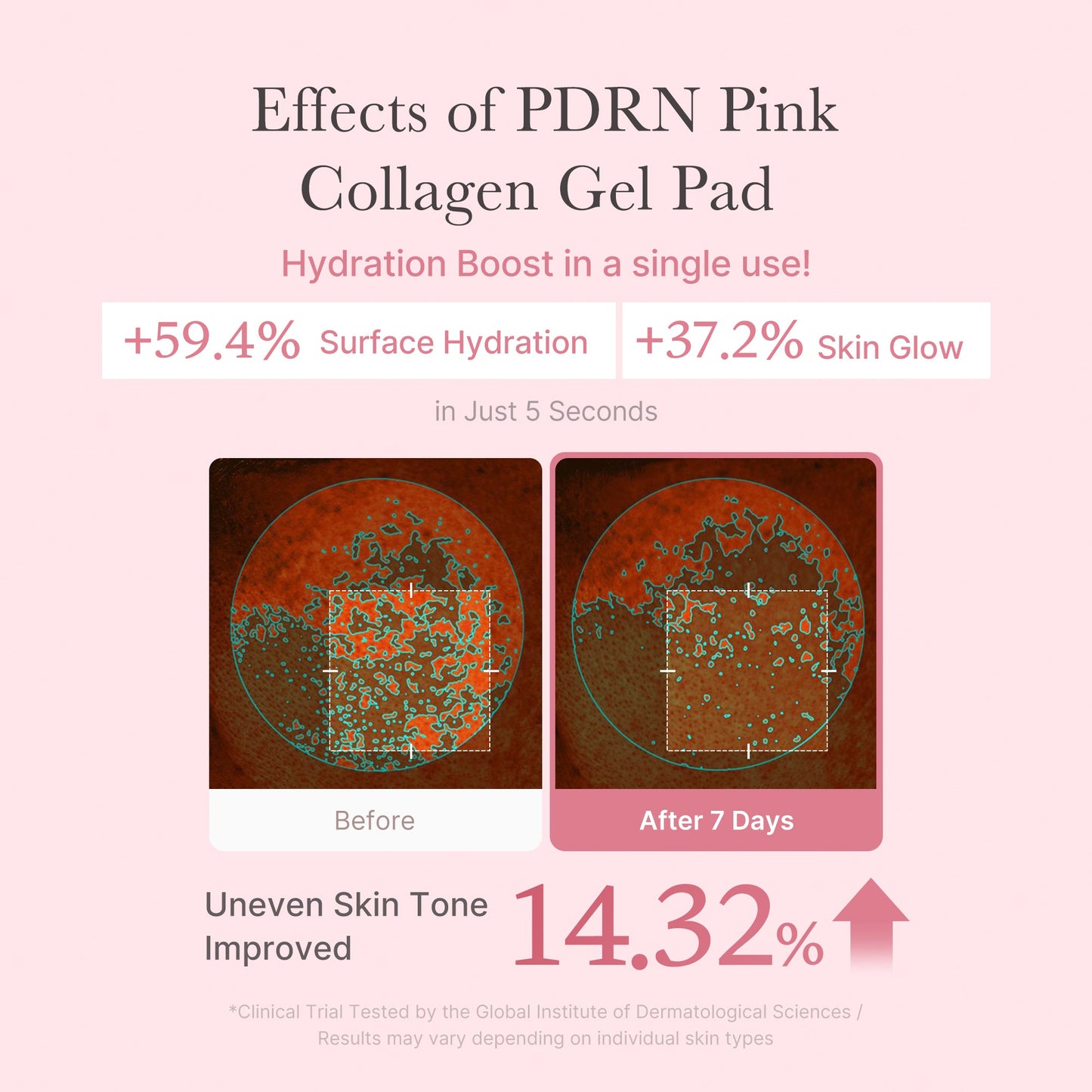 pdrn-pink-collagen-gel-toner-pad-n5 PDRN_04_f9a16a56-8d9e-4c47-a635-ed34ec3ed571.jpg