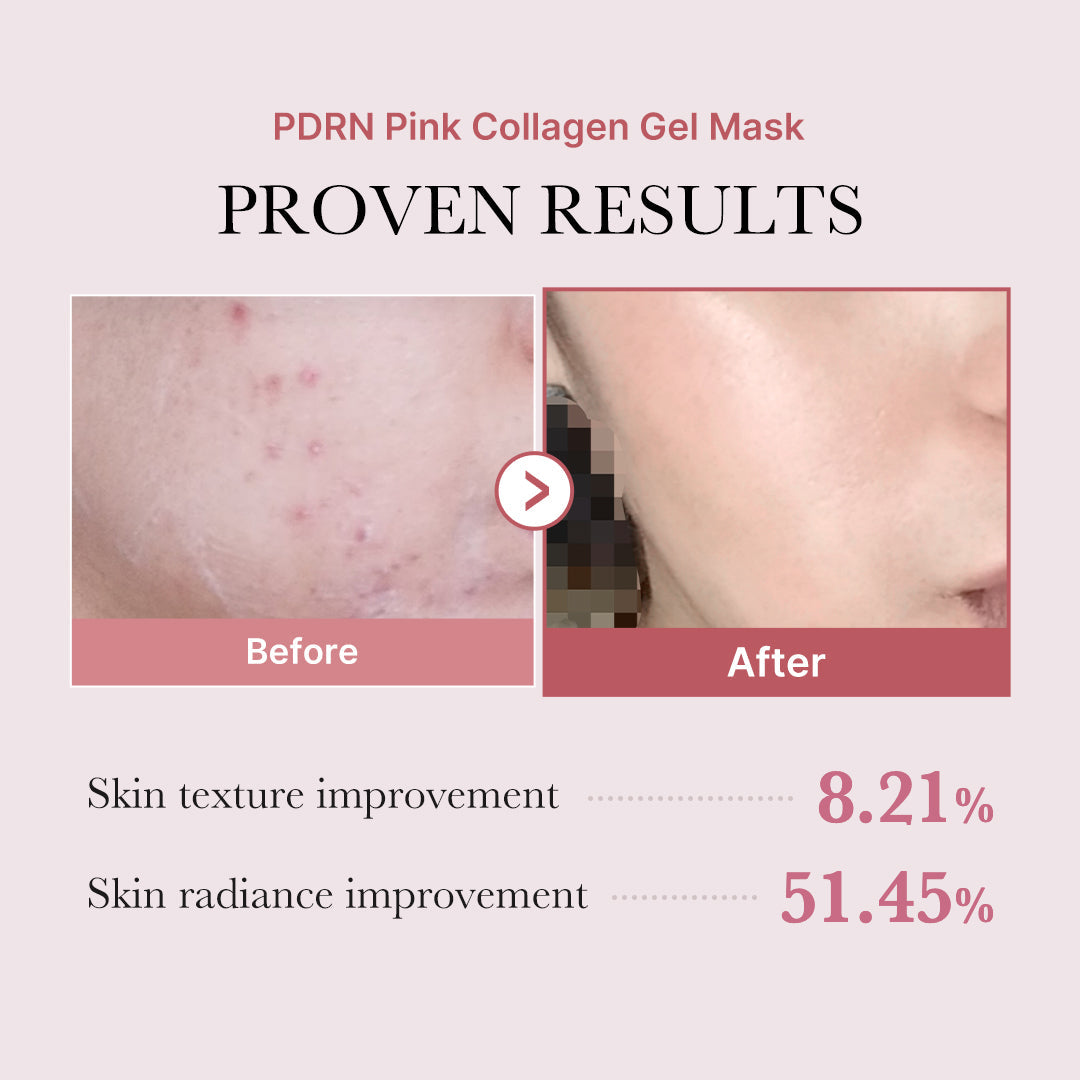 salmon-pdrn-pink-collagen-jelly-gel-mask-x3 PDRN_12.jpg