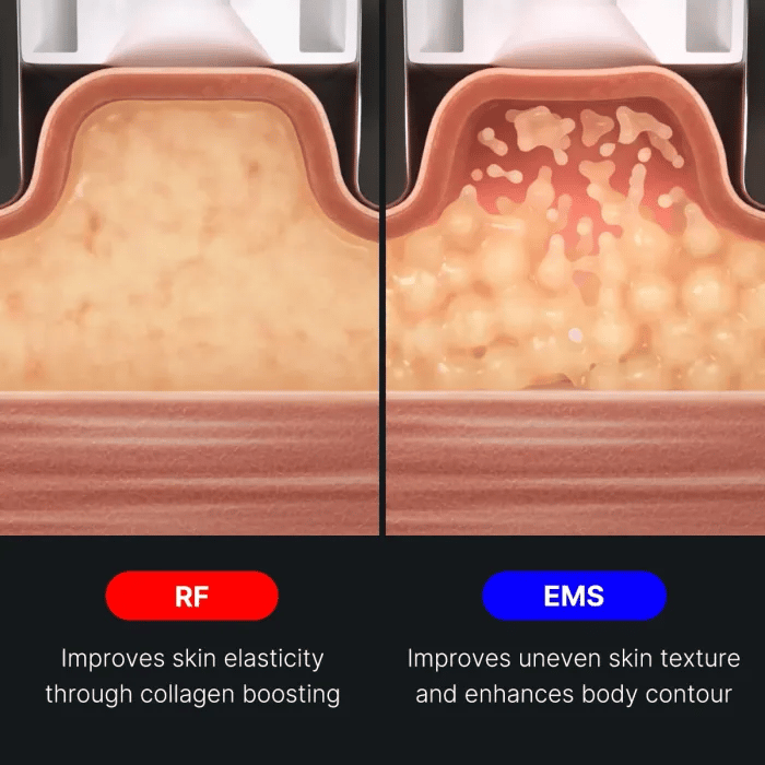 age-r-contour-body-shot-v1 img.webp